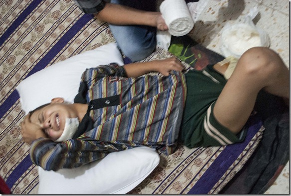 طفل سوري مصاب يتألم من جراحه - A little Syrian boy suffering Assad crimes injury pains